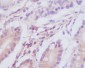 Anti-MAP1LC3A/Lc3A Rabbit Monoclonal Antibody